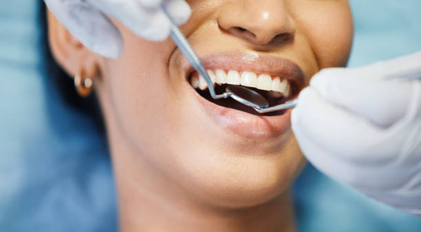 Best Urgent Care for Lost Fillings or Crowns in Centreville, MD