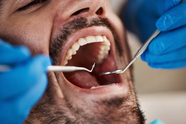 Best Emergency Treatment for Dental Infections or Abscesses in Centreville, MD